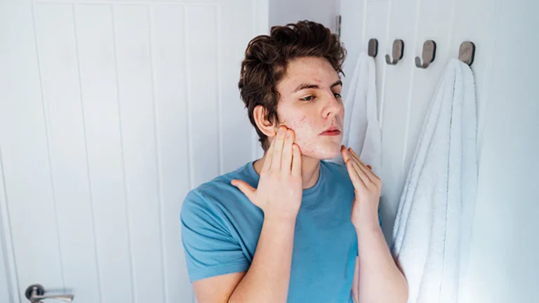 daily skincare routine for teenage boys